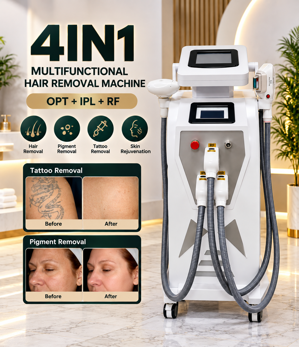 4-in-1 Multifunctional Hair Removal Machine – OPT + IPL + RF